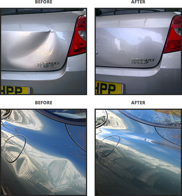 Dent removal techniques - Dentman